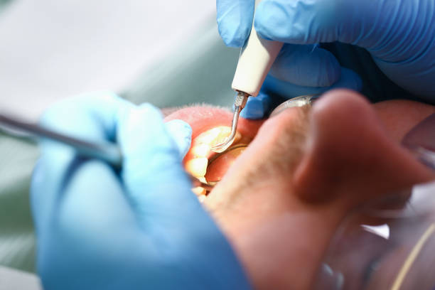 Best Walk-In Emergency Dentist in Maineville, OH